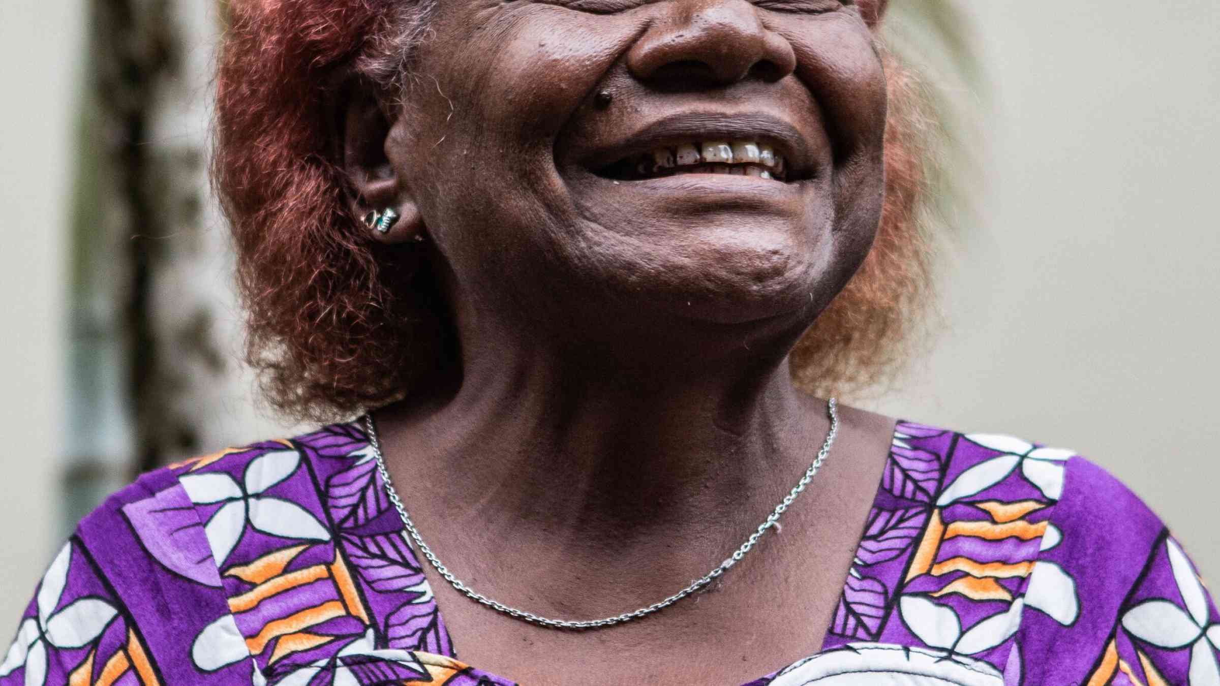 Agnes Titus, Nazareth Centre for Rehabilitation in Bougainville